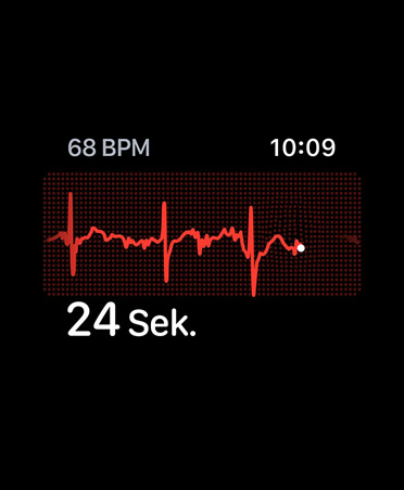 EKG App, Schläge pro Minute in der oberen rechten Ecke, Rhythmuslinie, Timer