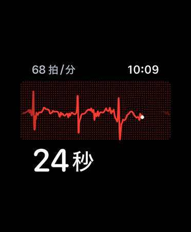 心電図アプリ、左上角に1分あたりの心拍数、心電図波形、タイマー