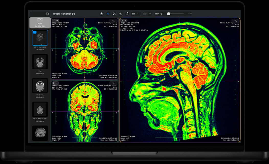  Scherm van MacBook Pro met Falcon MD